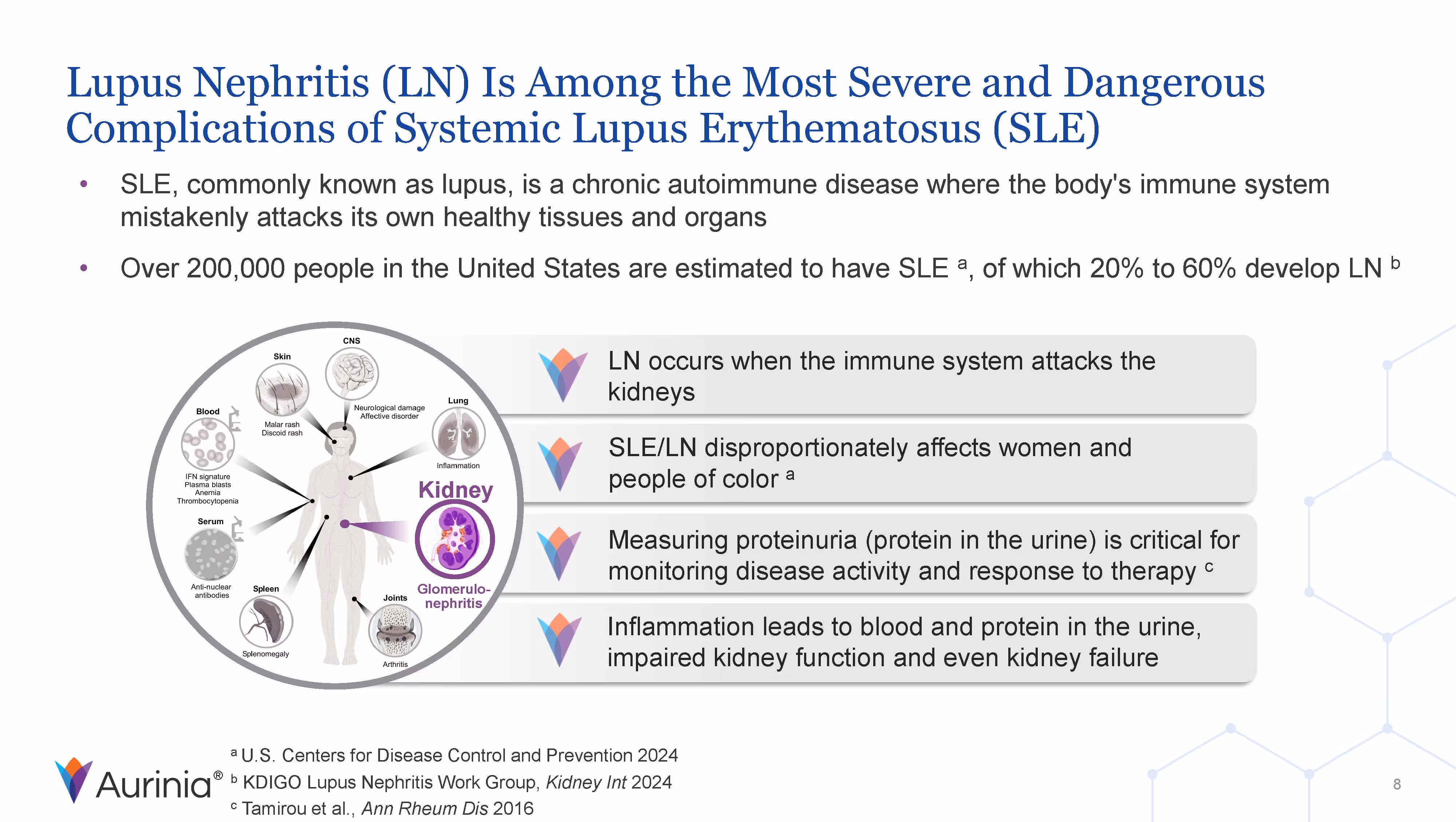 Diagram explaining Lupus Nephritis as a severe complication of systemic lupus erythematosus, showing affected organs and key points about kidney damage and disease monitoring.