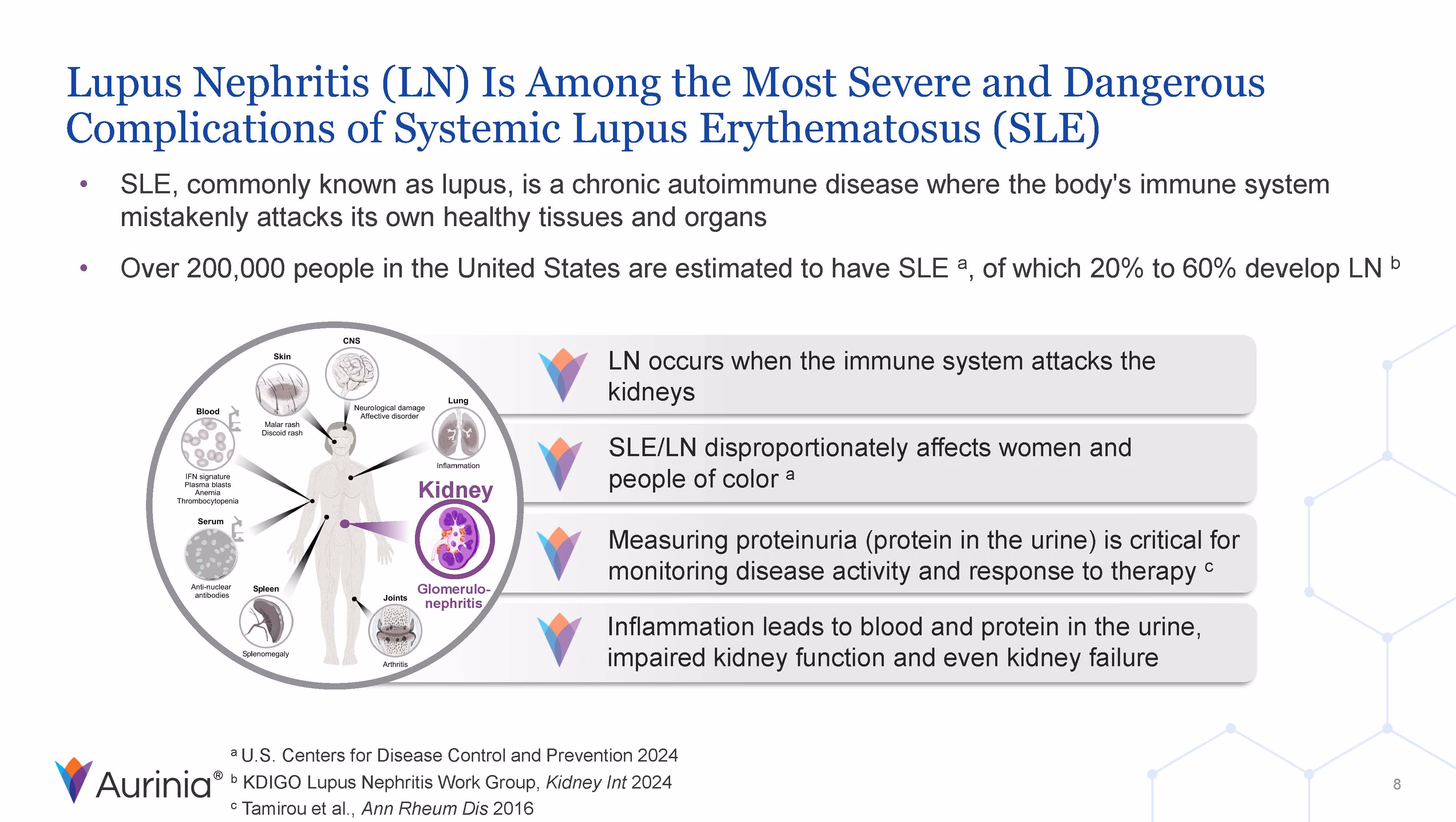 Diagram explaining Lupus Nephritis as a severe complication of systemic lupus erythematosus, showing affected organs and key points about kidney damage and disease monitoring.
