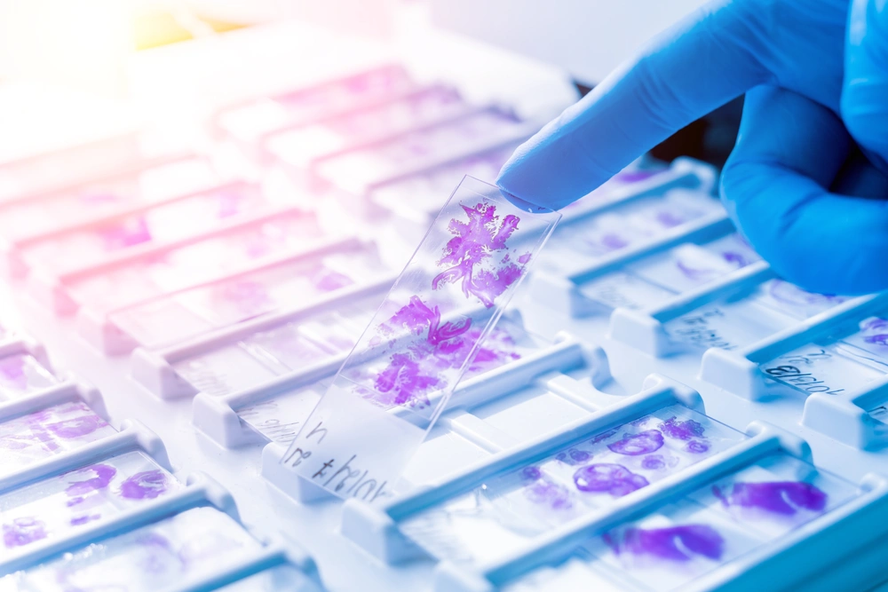 Gloved hand holding a stained microscope slide with purple cells above a tray of similar slides.