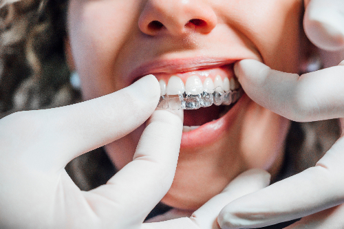 Cosmetic and sedation dentist in La Mesa near San Diego and El Cajon, CA