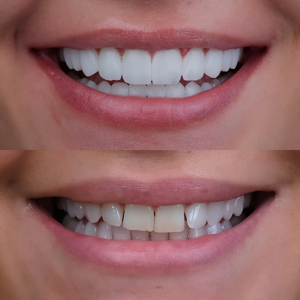 Cosmetic and sedation dentist in La Mesa near San Diego and El Cajon, CA