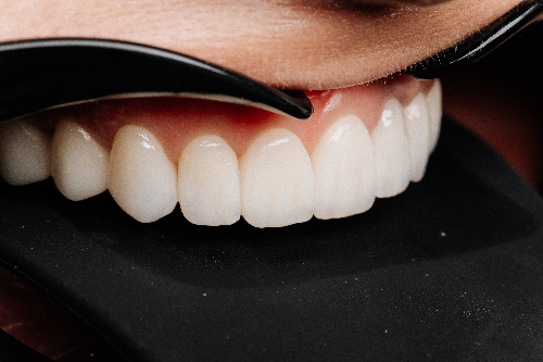 General and cosmetic dentist serving La Mesa, El Cajon and San Diego