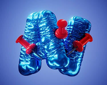 A 740 Percent Increase in What?