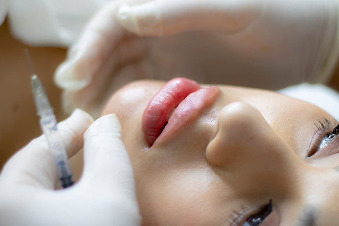 La biorivitalizzazione per il trattamento della pelle