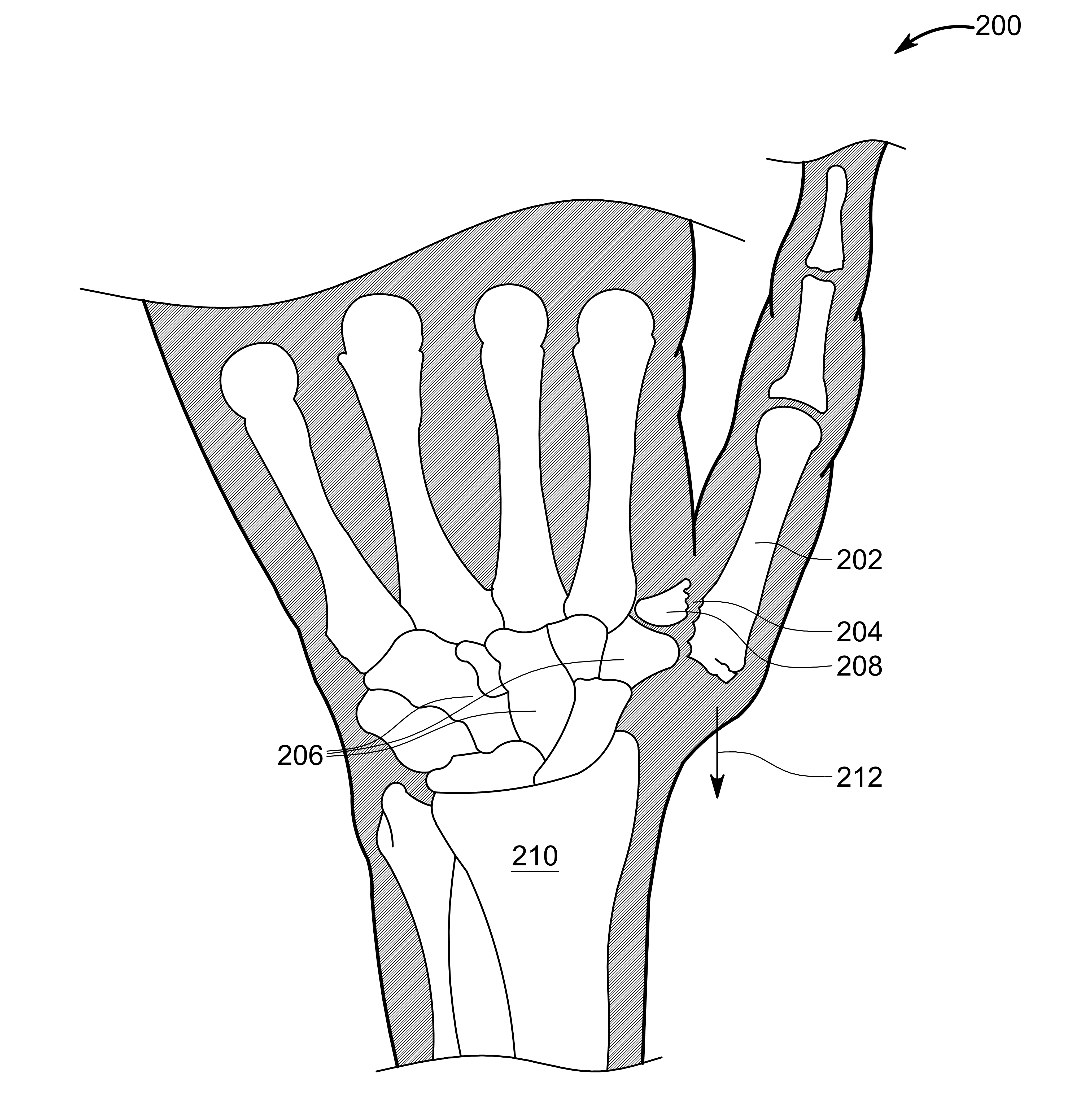 Utility Patent Drawings Number 17
