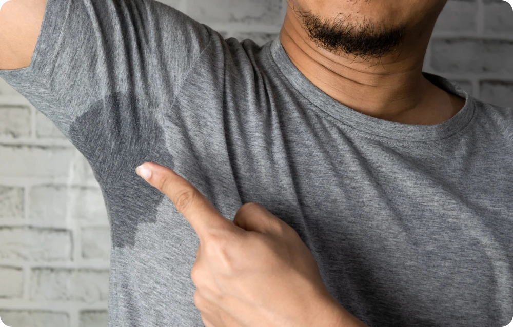Man pointing at underarm sweat stain on grey shirt – example of excessive sweating before miraDry treatment