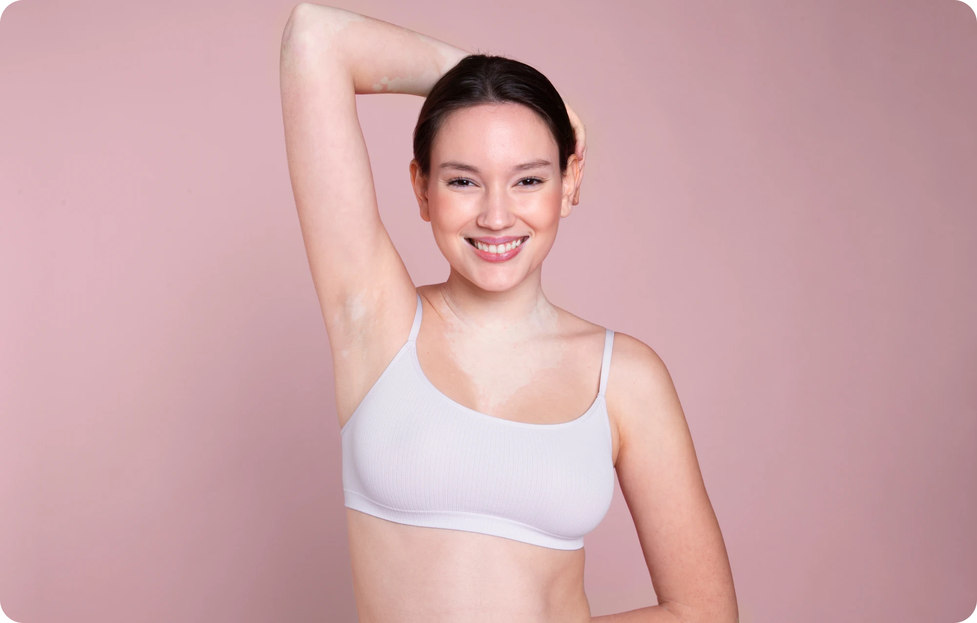 Smiling woman showing smooth underarm after miraDry treatment, wearing white top against pink background