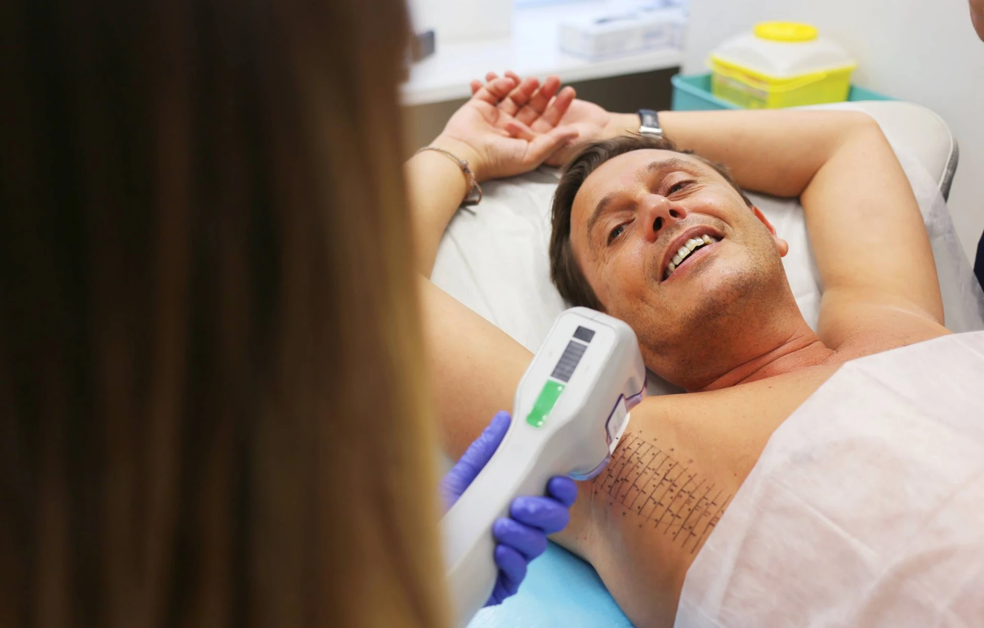 Man receiving Miradry procedure for permanent underarm sweat and odor control.