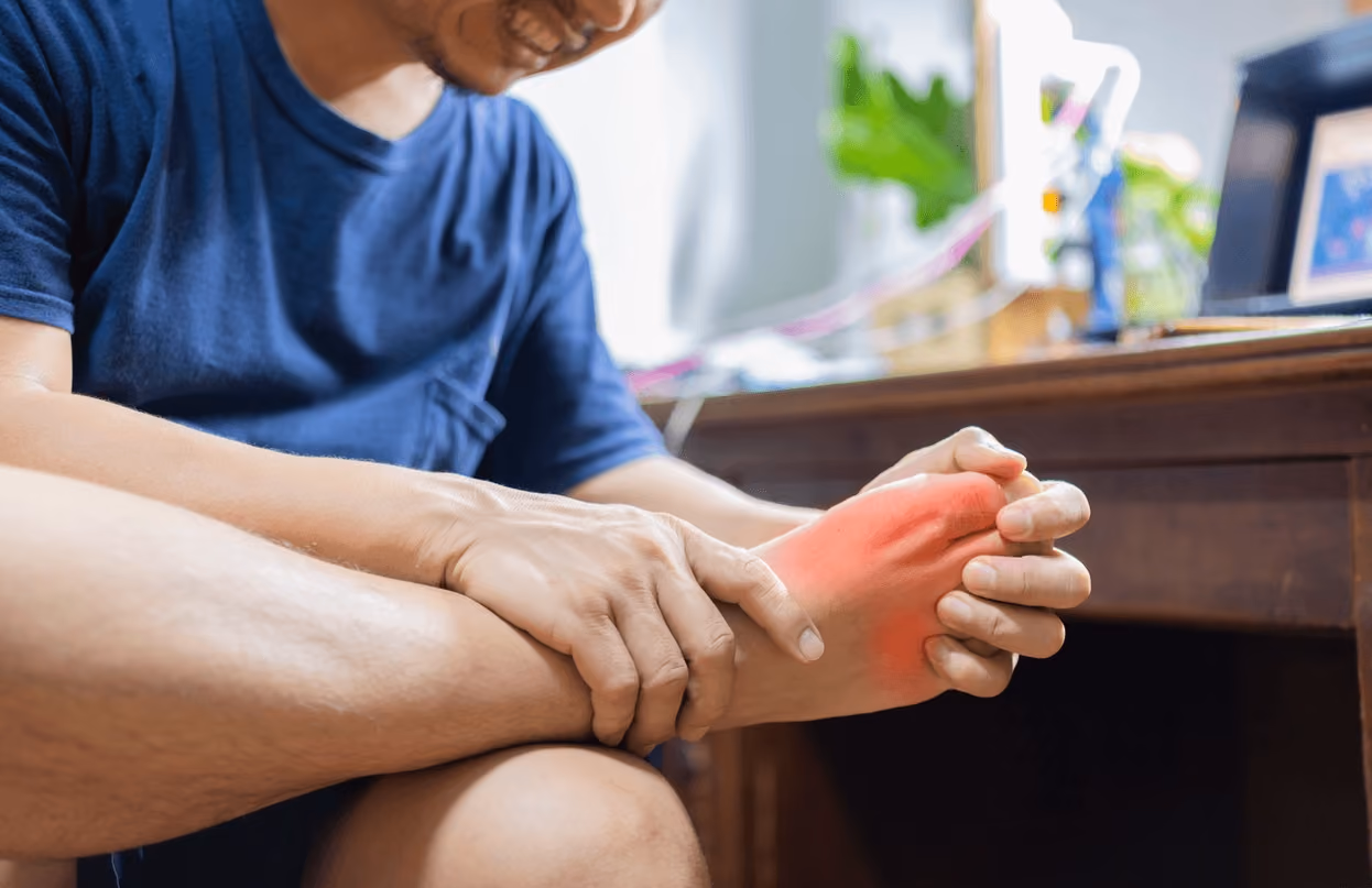 Man holding his inflamed foot in pain from gout, seeking treatment from the best podiatrist for gout in Los Angeles.