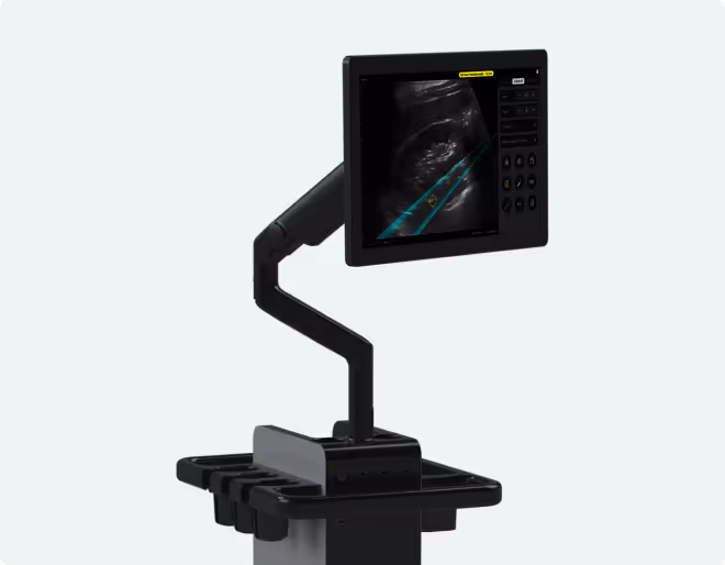 Medical ultrasound machine with a black adjustable monitor showing a sonogram image.