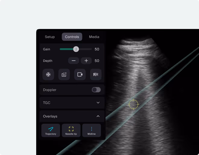 Ultrasound screen showing a grayscale image with a needle guidance overlay and control panel settings for gain, depth, Doppler, and overlays like trajectory, needle tip, and midline.