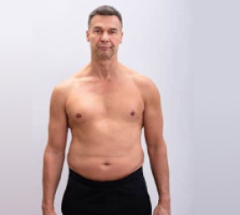 Middle-aged man before starting HGH therapy showing natural physique