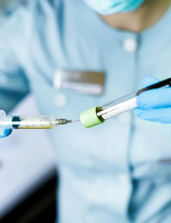 PRP injection vial for hair restoration therapy at Gameday Men’s Health, used in localized platelet-rich plasma treatments for hair loss.