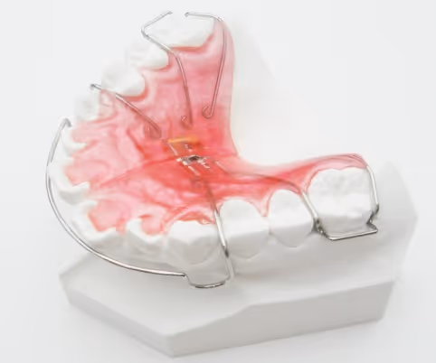 Plaque de Hawley orthodontique avec écarteur pour expansion - H32 Dental