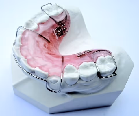 Plaque d'expansion distale orthodontique pour recul dentaire - H32 Dental