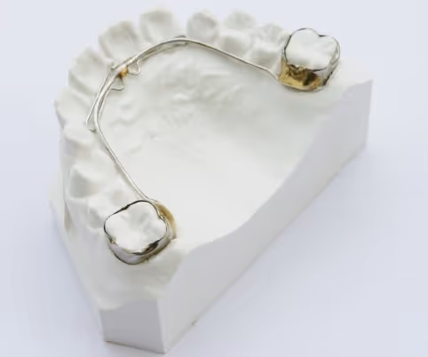 Arc lingual orthodontique pour maintien d'espace mandibulaire - H32 Dental