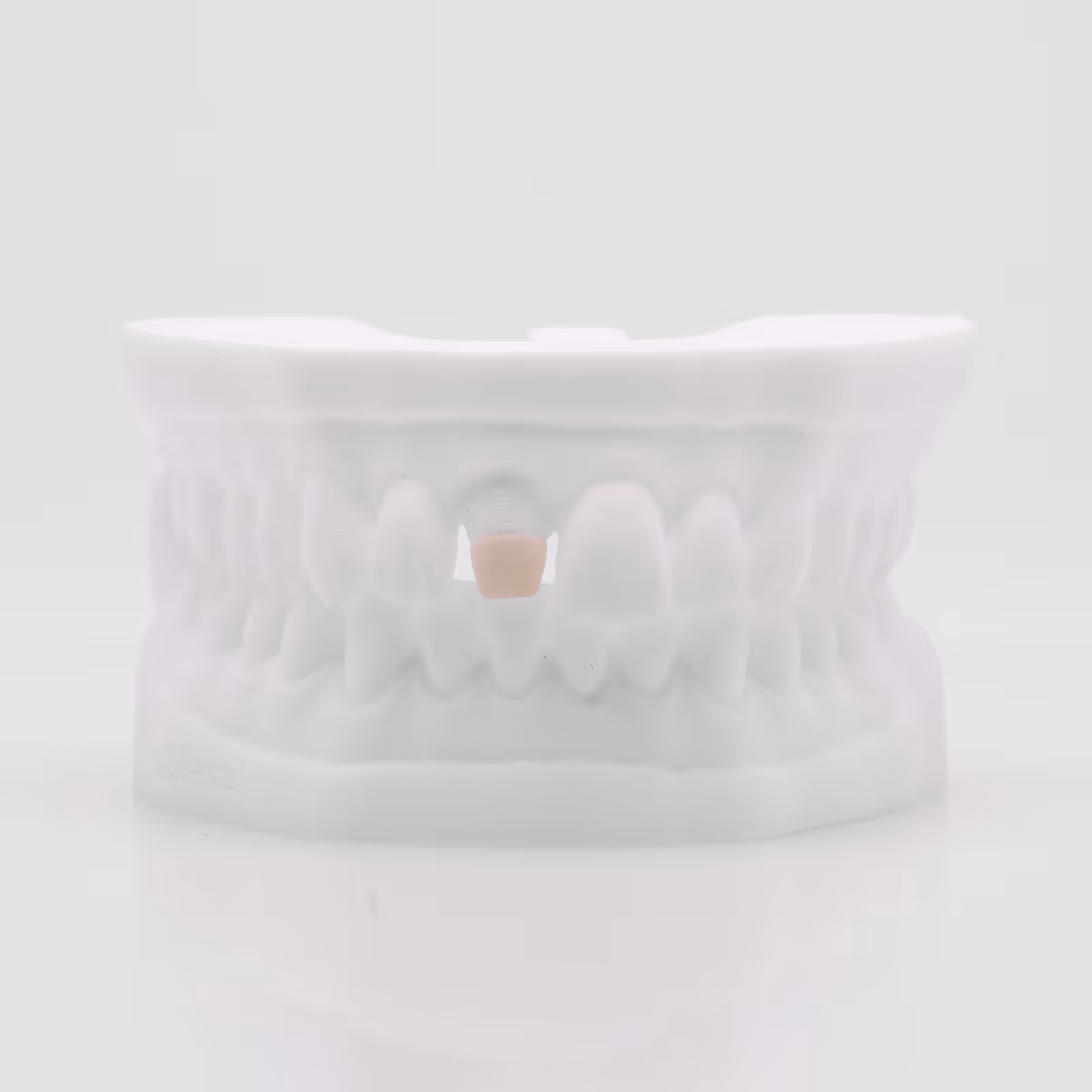 Inlay Core composite fibré usiné pour reconstitution esthétique - H32 Dental