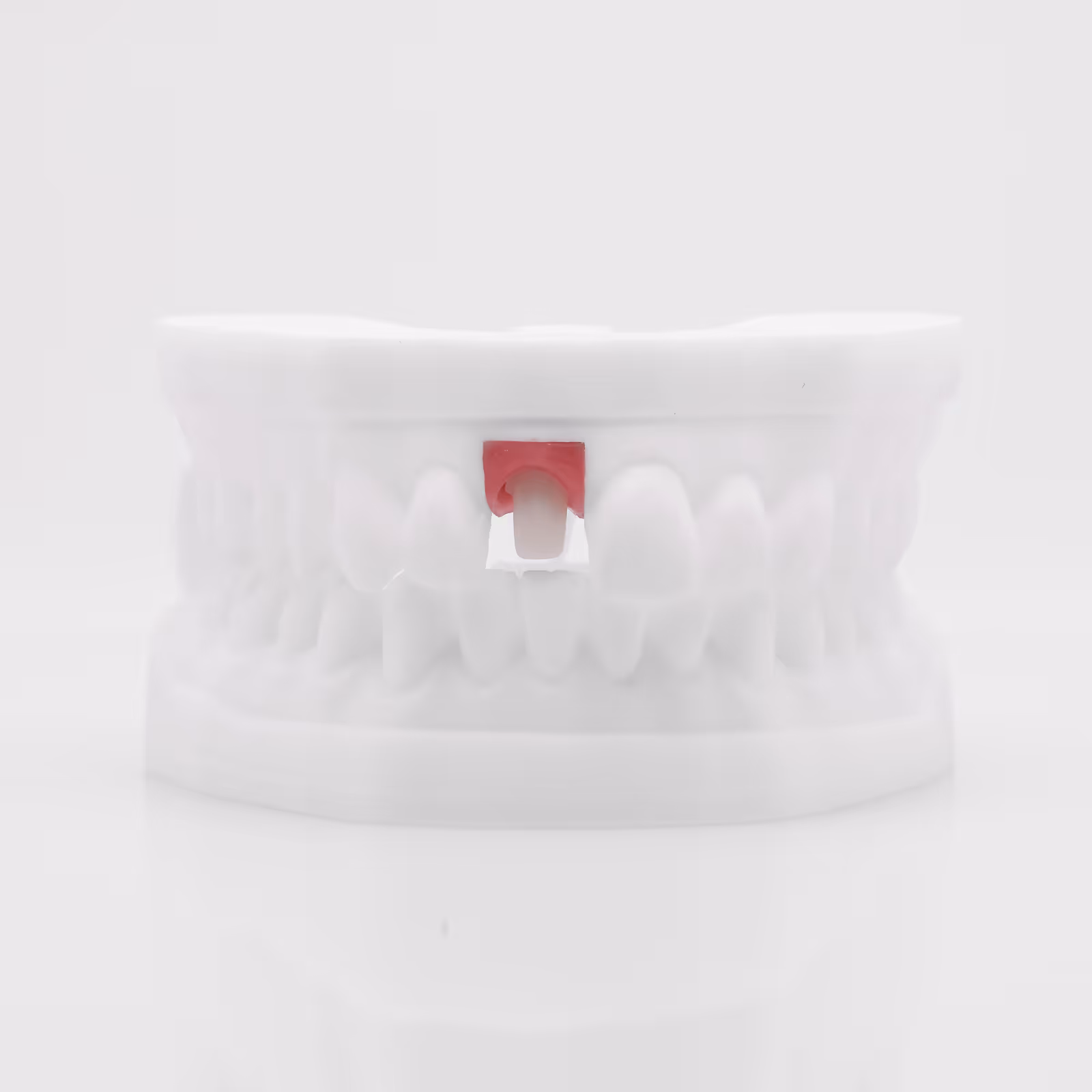Pilier anatomique usiné PEEK Ti-Base biocompatible pour implant - H32 Dental