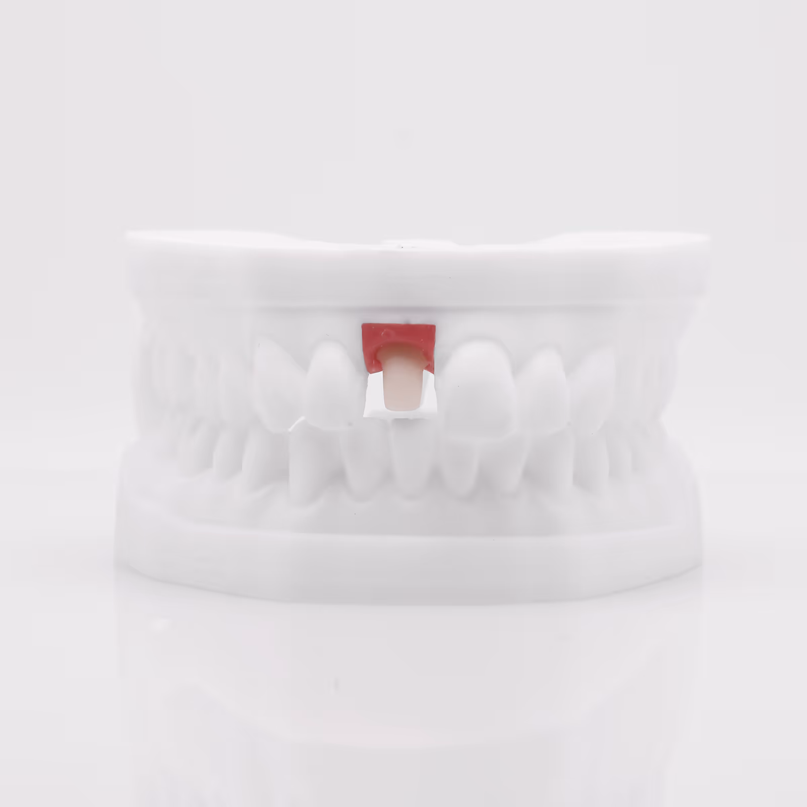 Pilier anatomique usiné E.max CAD Ti-Base pour implant esthétique - H32 Dental