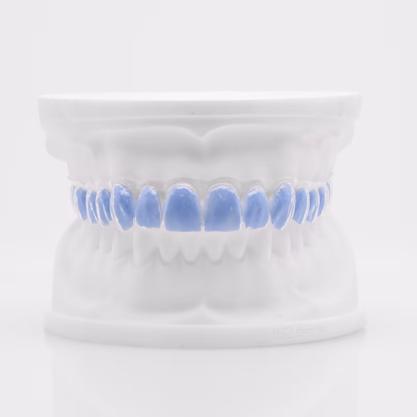 Custom bleaching tray for professional teeth whitening treatment - H32 Dental