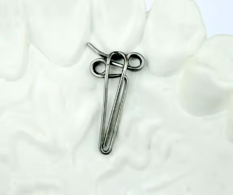 Type 3 orthodontic spring for precise tooth movement - H32 Dental
