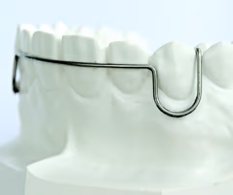 Type 1 vestibular arch for basic orthodontic alignment - H32 Dental