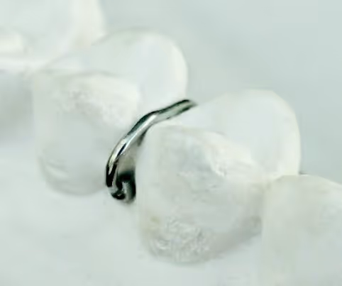 Ball clasp for reliable orthodontic appliance attachment - H32 Dental