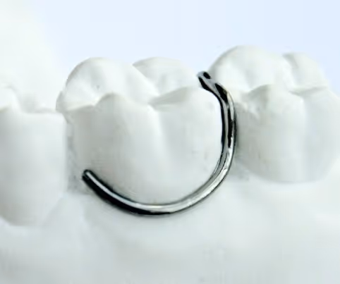 Single C-clasp for basic orthodontic appliance retention - H32 Dental
