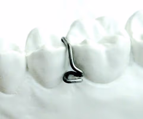 Triangle clasp for triangular orthodontic appliance attachment - H32 Dental