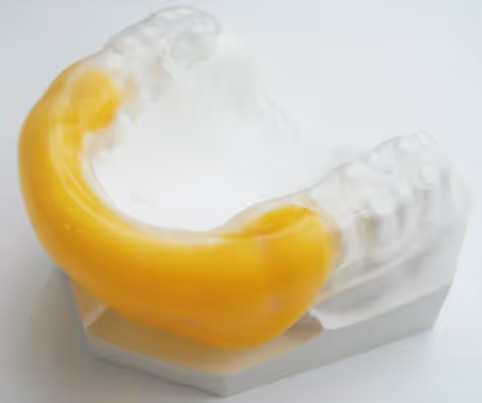 Type 2 dual press sports mouth guard for enhanced protection - H32 Dental