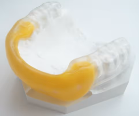 Type 3 dual press sports mouth guard for maximum protection - H32 Dental