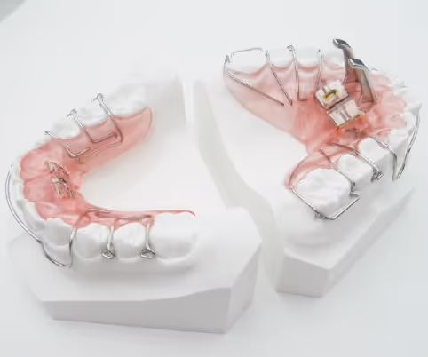 Jumping type bite raising appliance for orthodontic treatment - H32 Dental