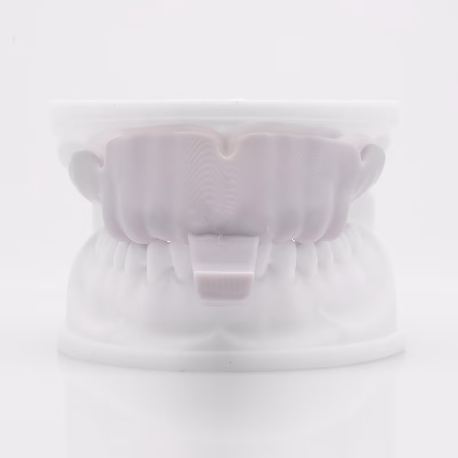 Individual impression tray for preliminary prosthetic stage - H32 Dental