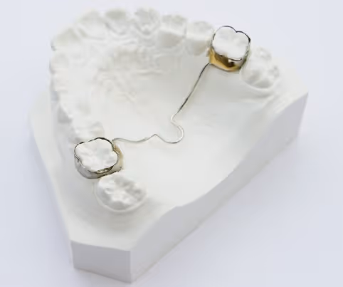 Palatal bar for orthodontic anchorage and support - H32 Dental