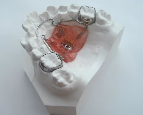 Haas palatal expansion plate with screw for orthodontic widening - H32 Dental