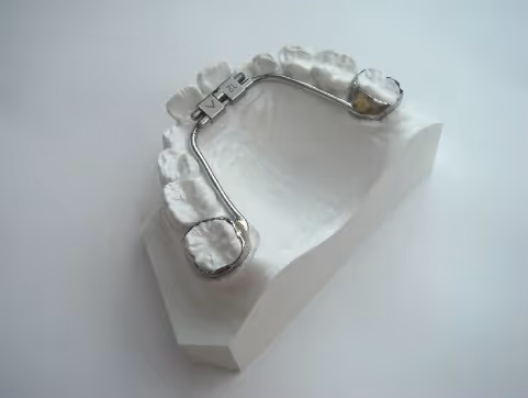 Compact rapid anterior expansion device for targeted orthodontic widening - H32 Dental