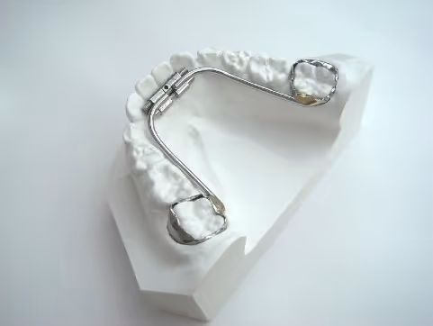 Bulldozer orthodontic appliance for tooth movement correction - H32 Dental
