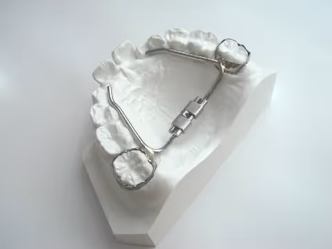 Mc Manara type compact rapid expansion device for orthodontic treatment - H32 Dental