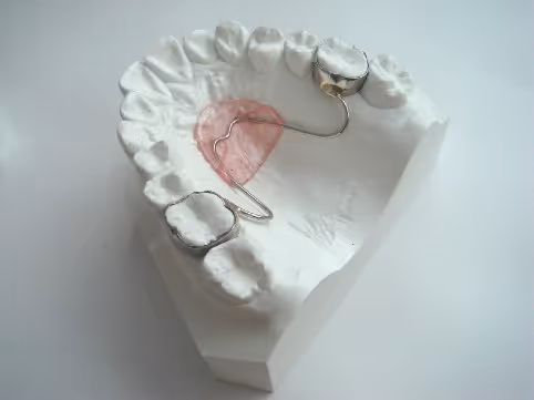 Nance holding arch for orthodontic space maintenance - H32 Dental