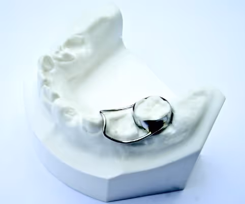Band and loop space maintainer for pediatric orthodontics - H32 Dental