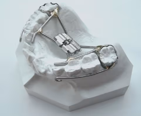 Rapid palatal expansion device for orthodontic treatment - H32 Dental