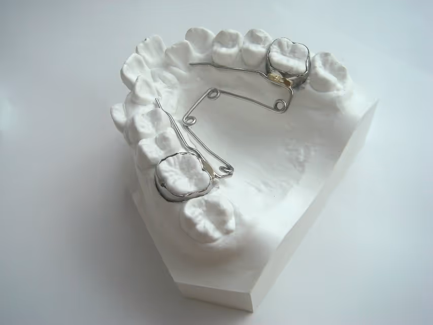 Quad Helix orthodontic expansion device for four-point palatal widening - H32 Dental