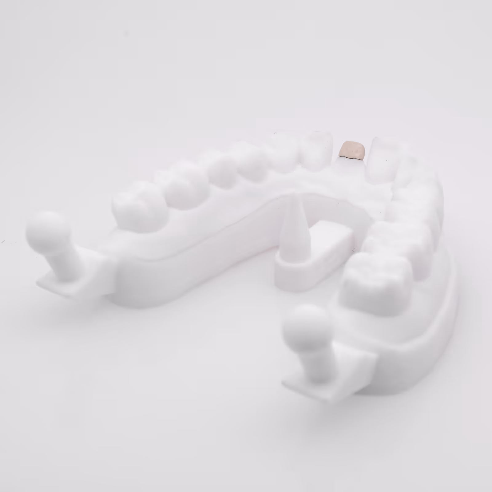 Ceramized cobalt-chromium inlay core with opaque coating - H32 Dental