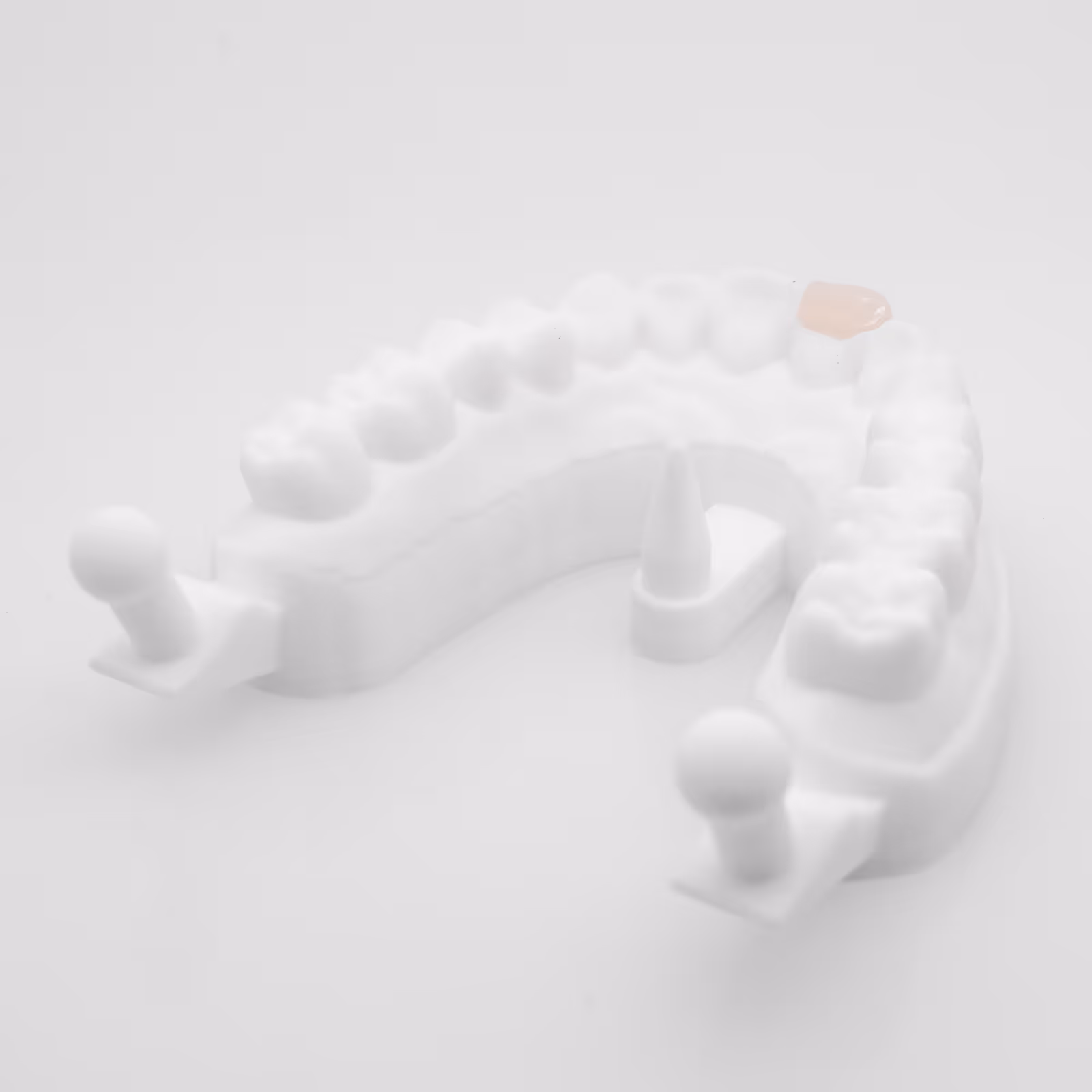 Empress CAD veneer for premium dental aesthetics - H32 Dental