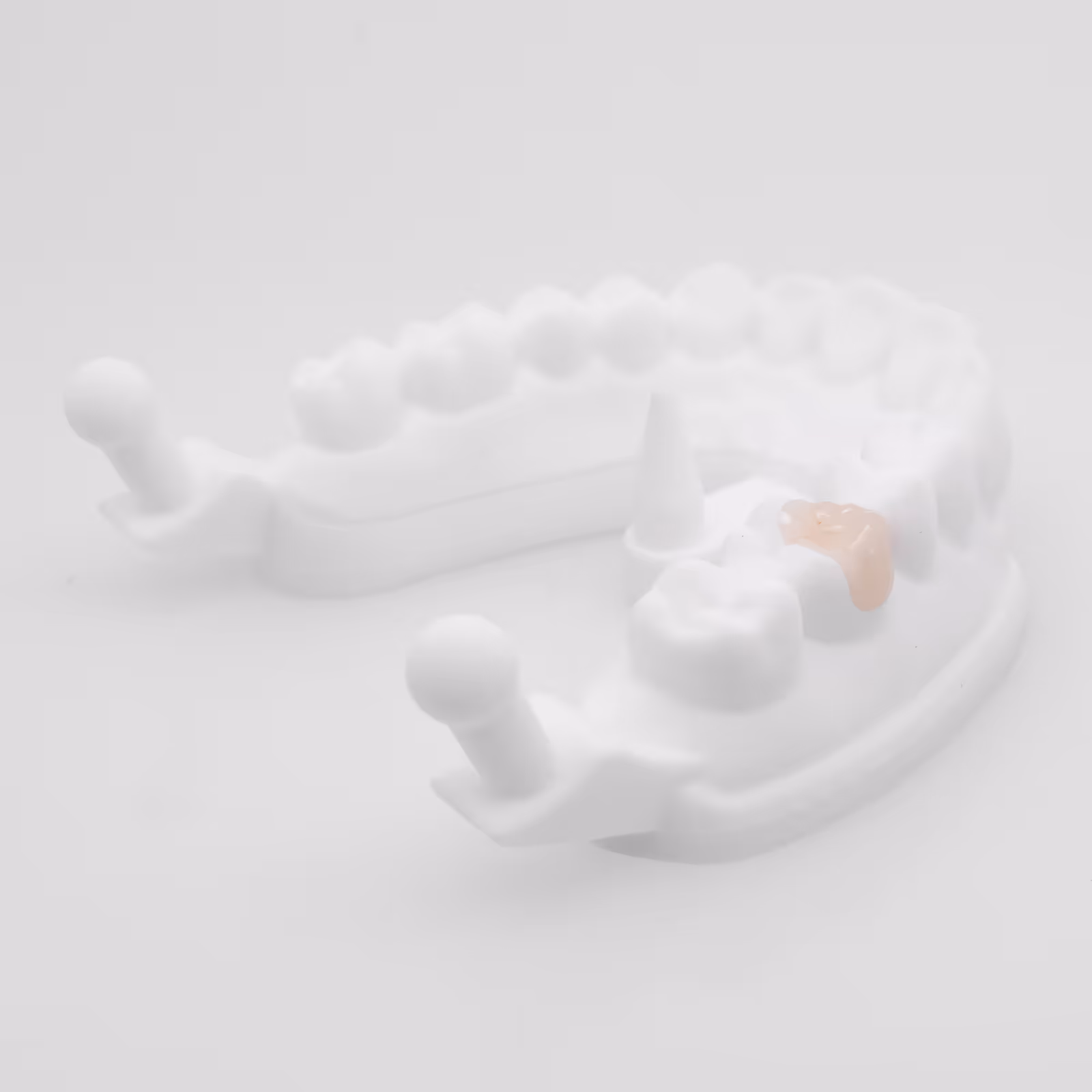 Empress CAD inlay onlay for premium partial restoration - H32 Dental