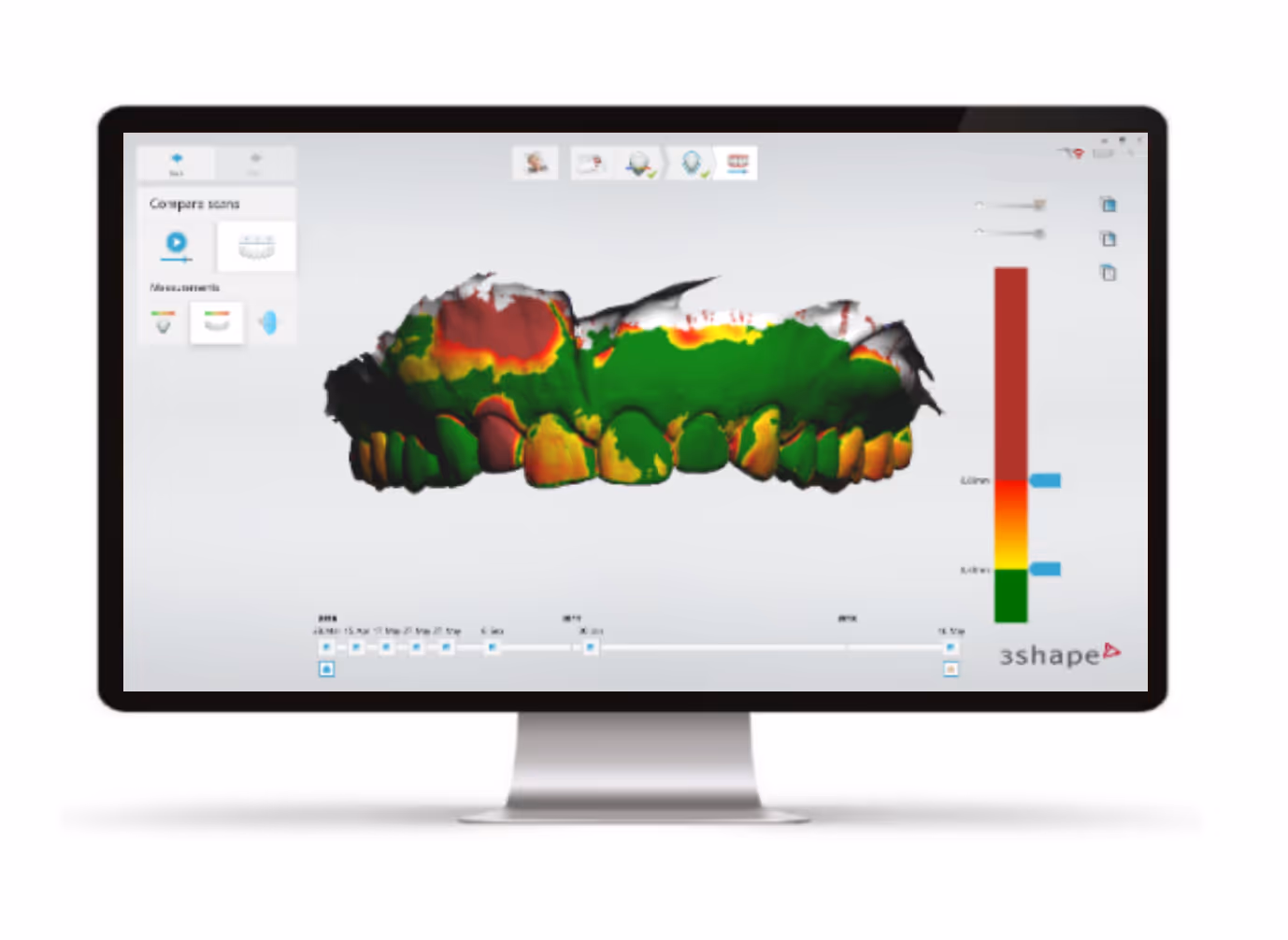 TRIOS Patient Monitoring Caries - Technical detection documentation - H32 Dental