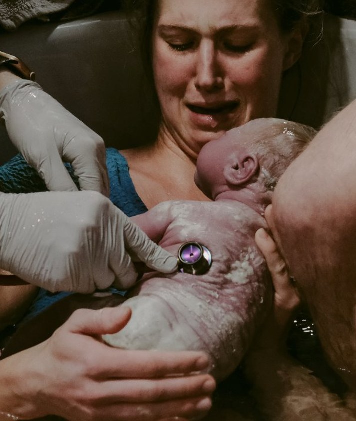 A mother in distress moments after birth, as clinicians check her newborn