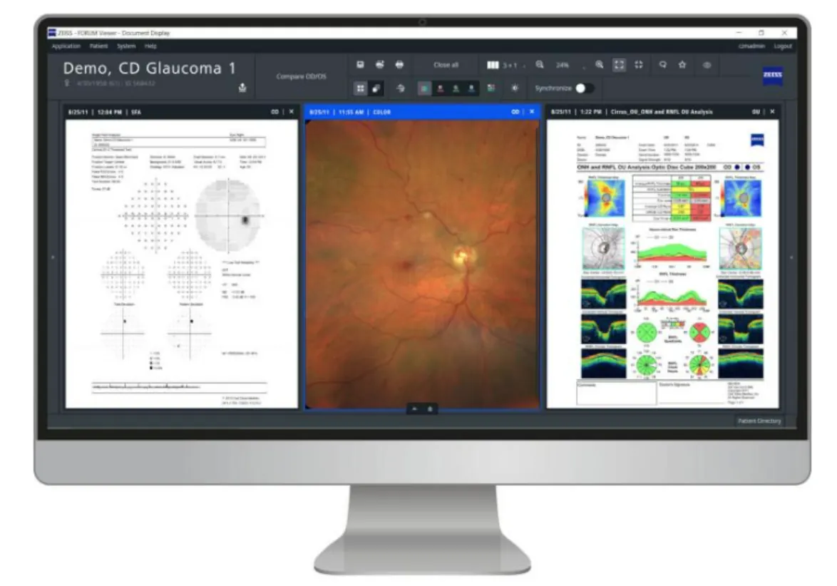 Zeiss Forum - chytré řešení pro správu očních dat