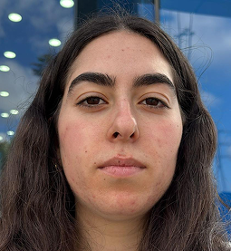 קוסמטיקאית משתמשת במכשור מתקדם לטיפול בפנים