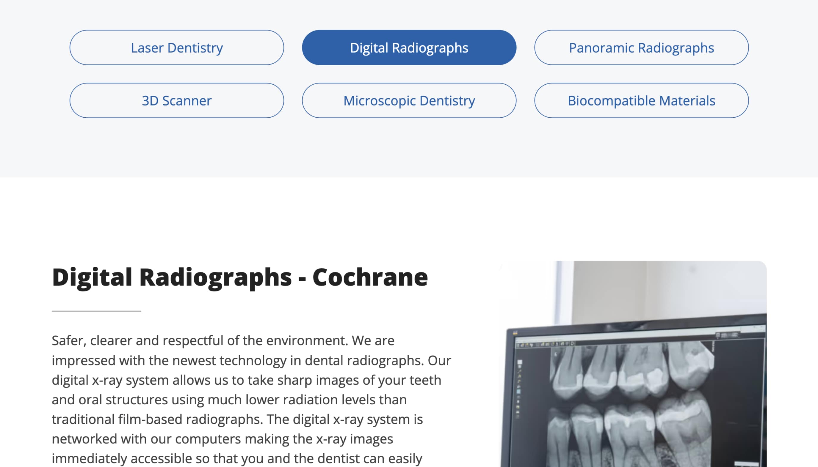 Computer monitor displaying digital dental X-ray images of teeth.